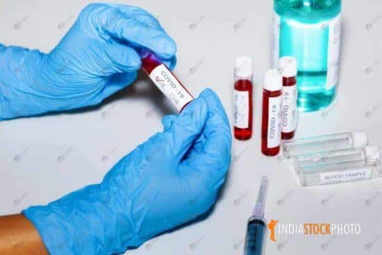 Healthcare worker holds blood sample vial at medical lab