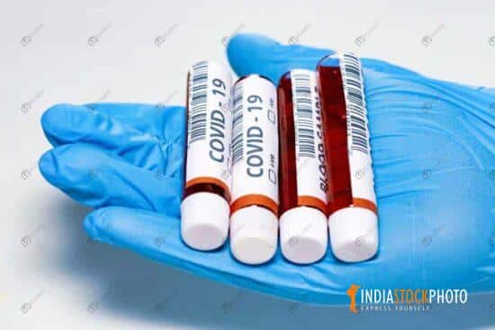 Blood sample vials on the palm of a hand wearing medical gloves