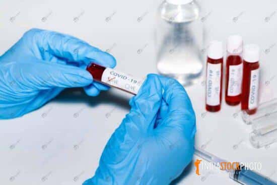 Doctor examines Covid 19 positive blood sample of patient