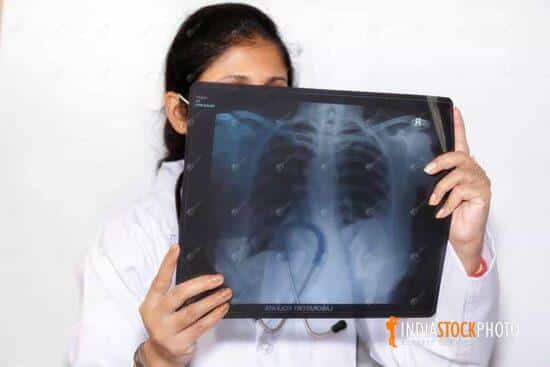 Lady doctor inspects chest x-ray plate at healthcare clinic