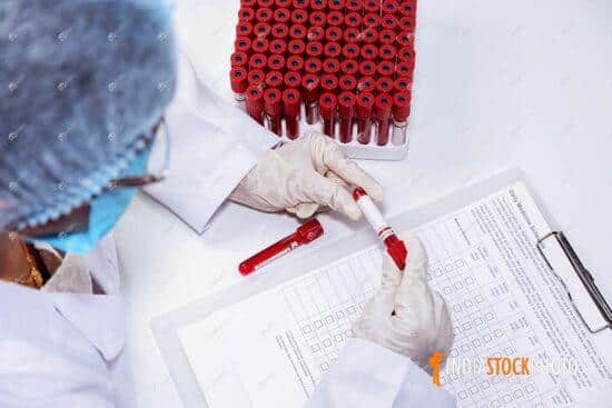 Medical lab assistant examine blood sample vial of patients
